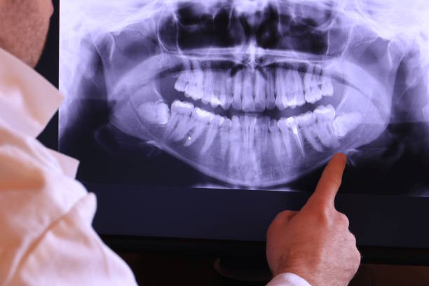 Best Emergency Dentist for Knocked-Out Tooth in Westover, AL