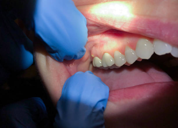 Best Emergency Cosmetic Dentistry in Westover, AL